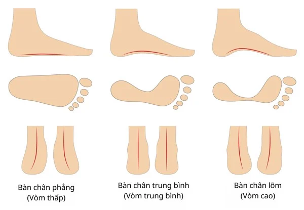 Phân loại vòm bàn chân: cao, trung bình và phẳng ảnh hưởng đến cách chọn giày leo núi