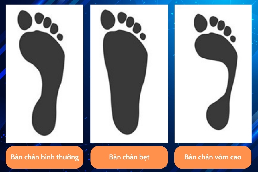 Minh họa các loại vòm bàn chân, hướng dẫn nhận biết đối tượng không nên chạy bộ không mang giày
