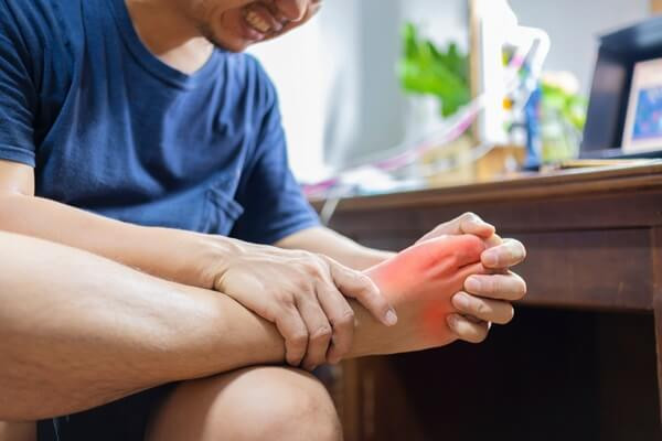 Hình ảnh bàn chân bị sưng do Gout, nguyên nhân gây đau mu bàn chân