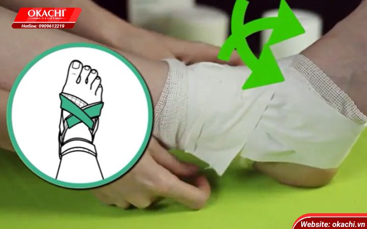 Kỹ thuật quấn băng theo hình chữ X (heel locks) để khóa gót chân và ổn định cổ chân khi đá bóng