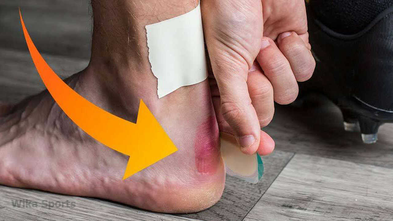 Sử dụng băng keo thể thao để bảo vệ những điểm nhạy cảm trên bàn chân, giảm ma sát và ngăn ngừa phồng rộp khi đá bóng