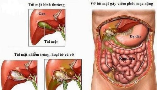 Tầm quan trọng của phối hợp nhóm giữa các cá nhân để đạt được mục tiêu chung